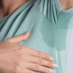 Woman with sweat stains on clothes, showing symptoms of Hyperhidrosis in Leesburg, FL.