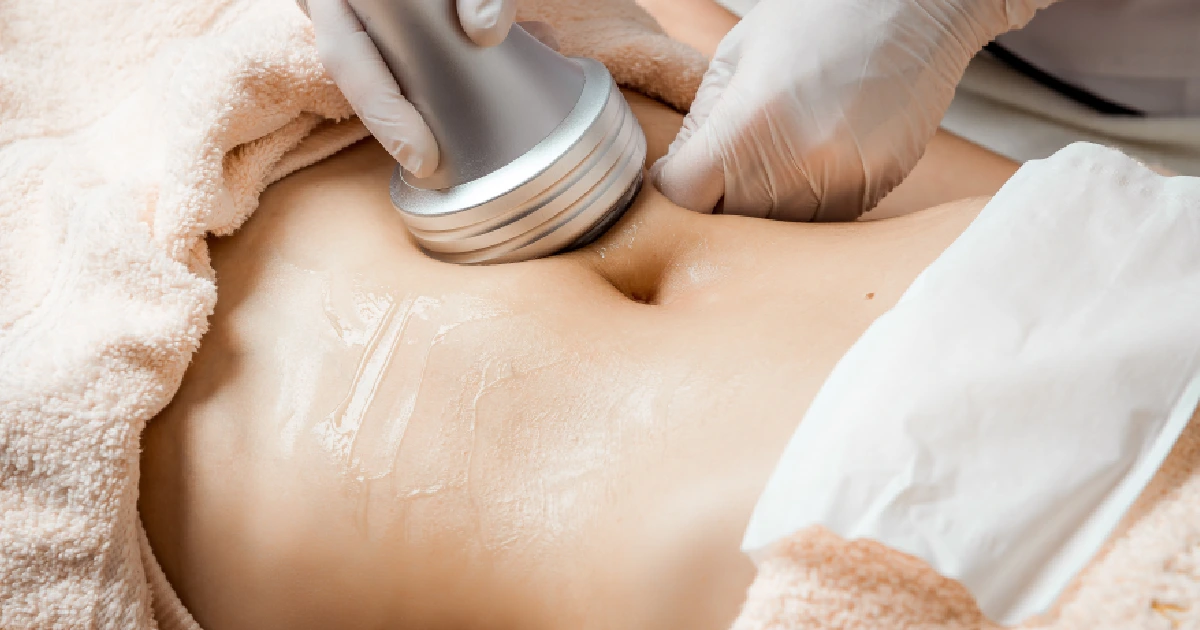 A woman receiving Viora V-Form in Leesburg, FL