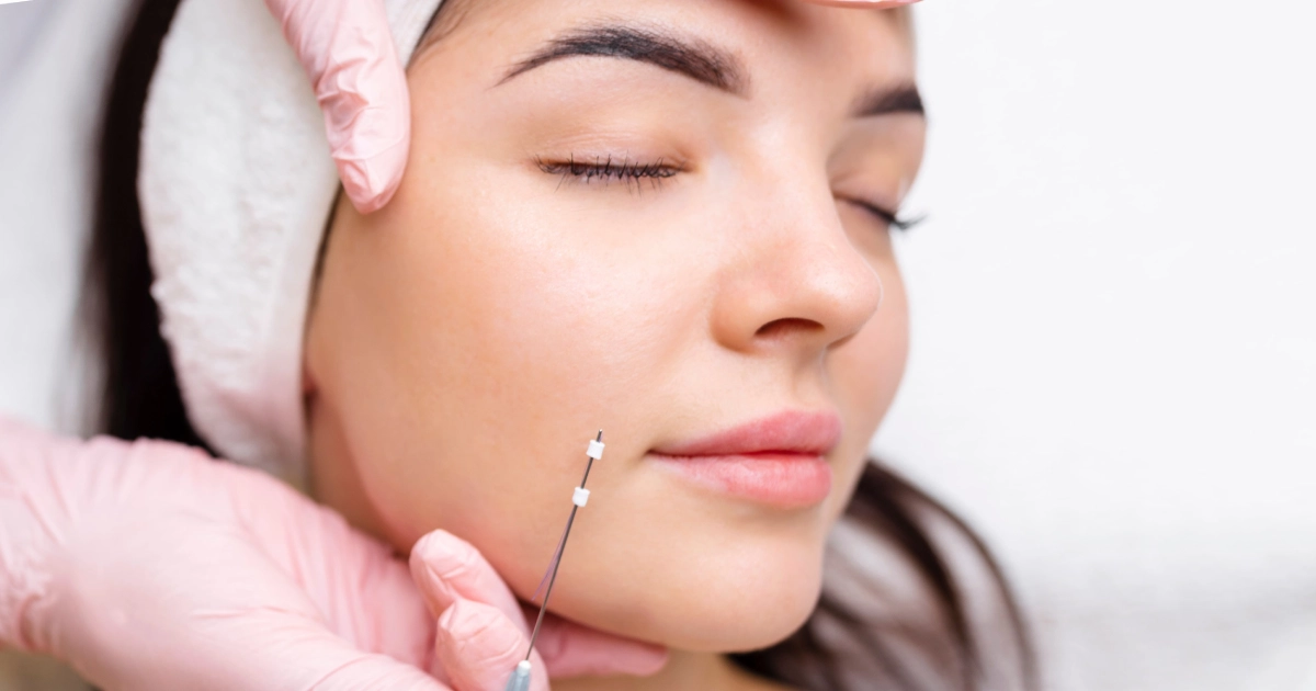 A woman with closed eyes receives a PDO thread treatment on her cheek from a gloved medical professional in Leesburg, FL.