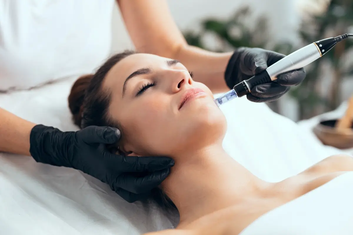 dermapen-microneedling-treatments-service-at-mwsmedicalspa-in-Leesburg-FL
