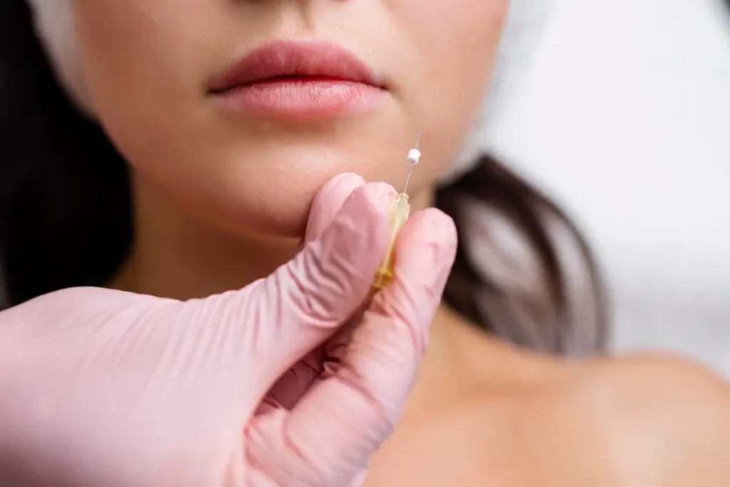 pdo-Threads-benifits–service-at-mwsmedicalspa-in-Leesburg, FL.webp