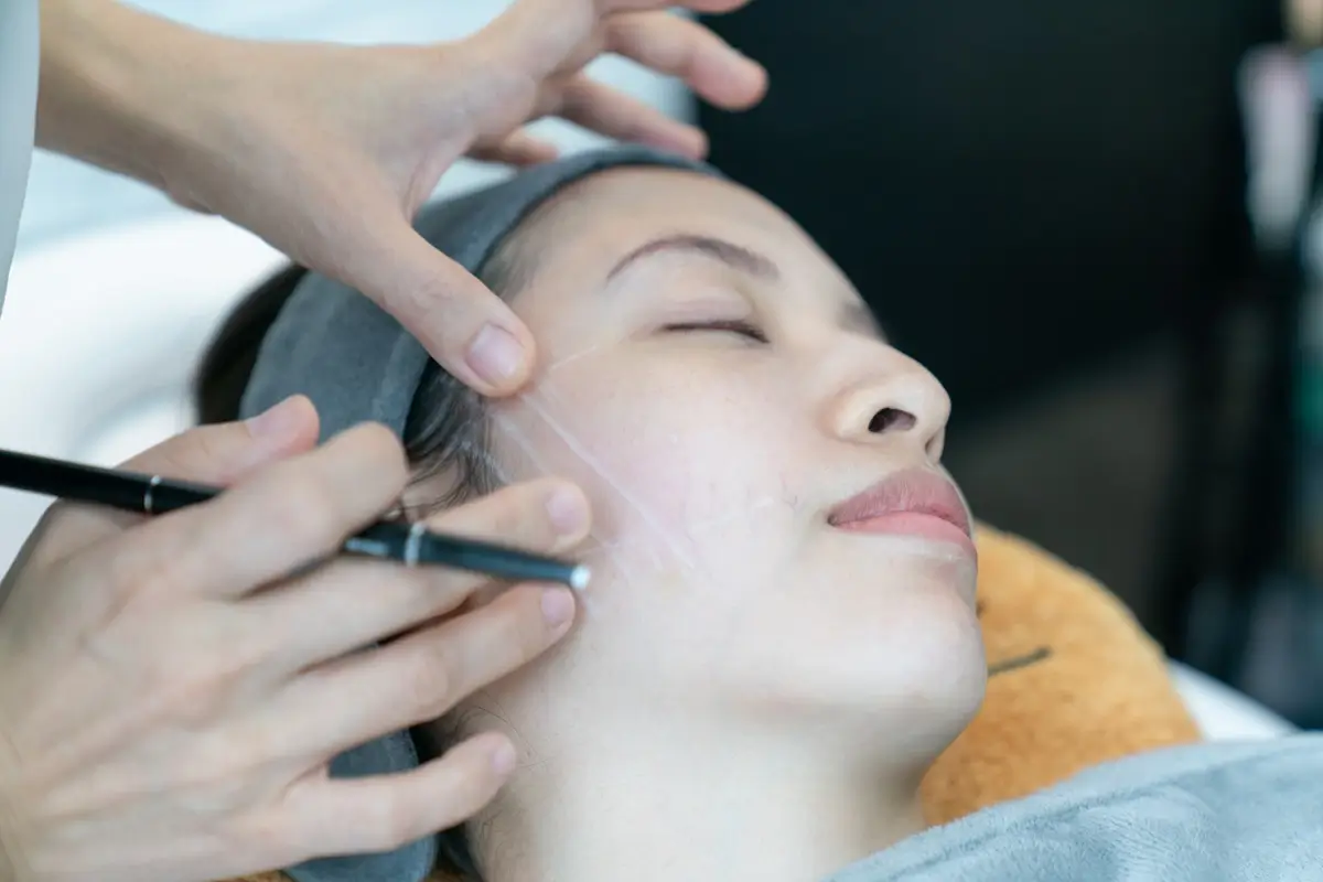 pdo-Threads-treatments-service-at-mwsmedicalspa-in-Leesburg, FL