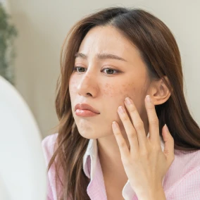 Spots-mwsmedicalspa-in-Leesburg-FL