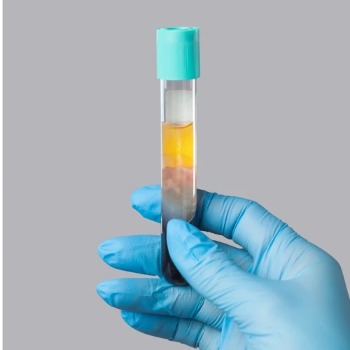 prp_prf_benefits_mwsmedicalspa_in_leesburg