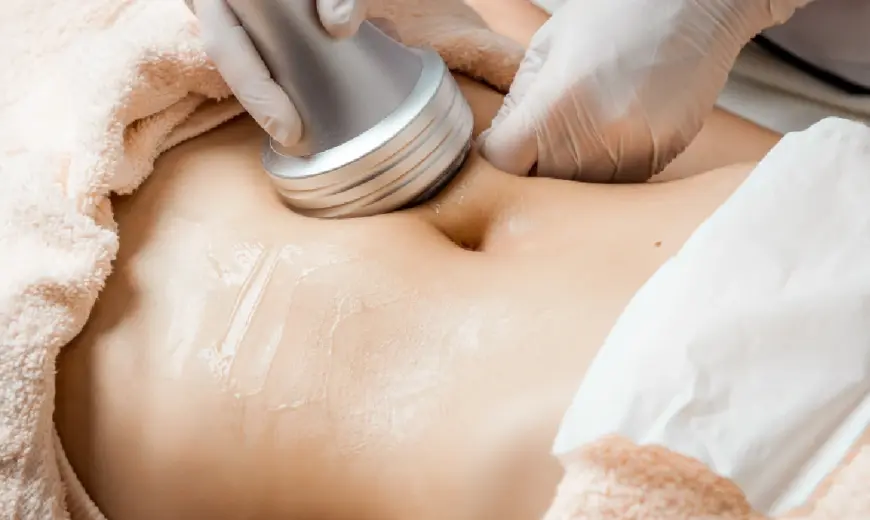 A woman receiving Viora V-Form in Leesburg, FL