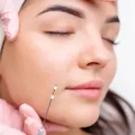 A woman with closed eyes receives a PDO thread treatment on her cheek from a gloved medical professional in Leesburg, FL.
