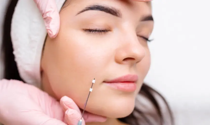 A woman with closed eyes receives a PDO thread treatment on her cheek from a gloved medical professional in Leesburg, FL.